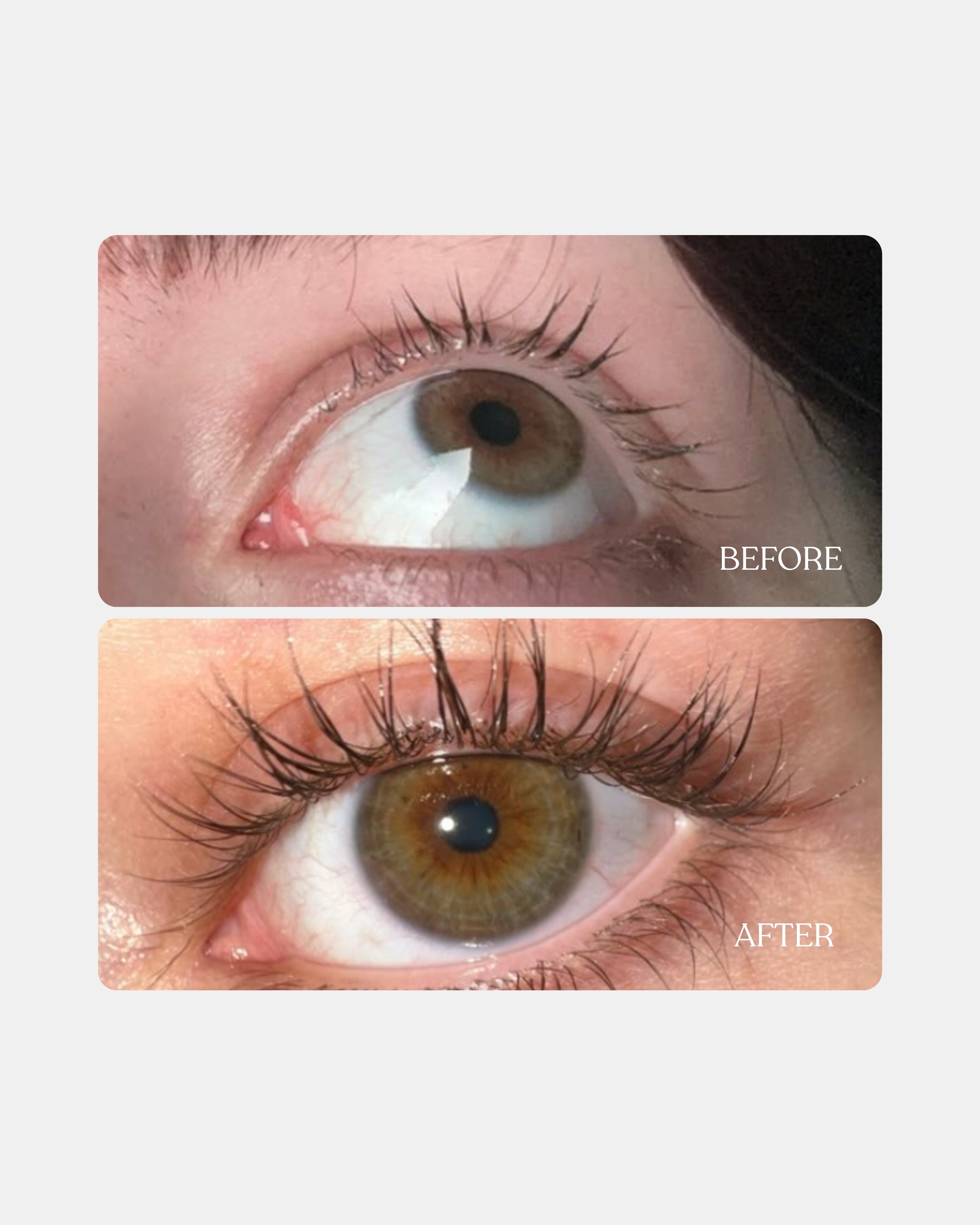 Eyelash serum