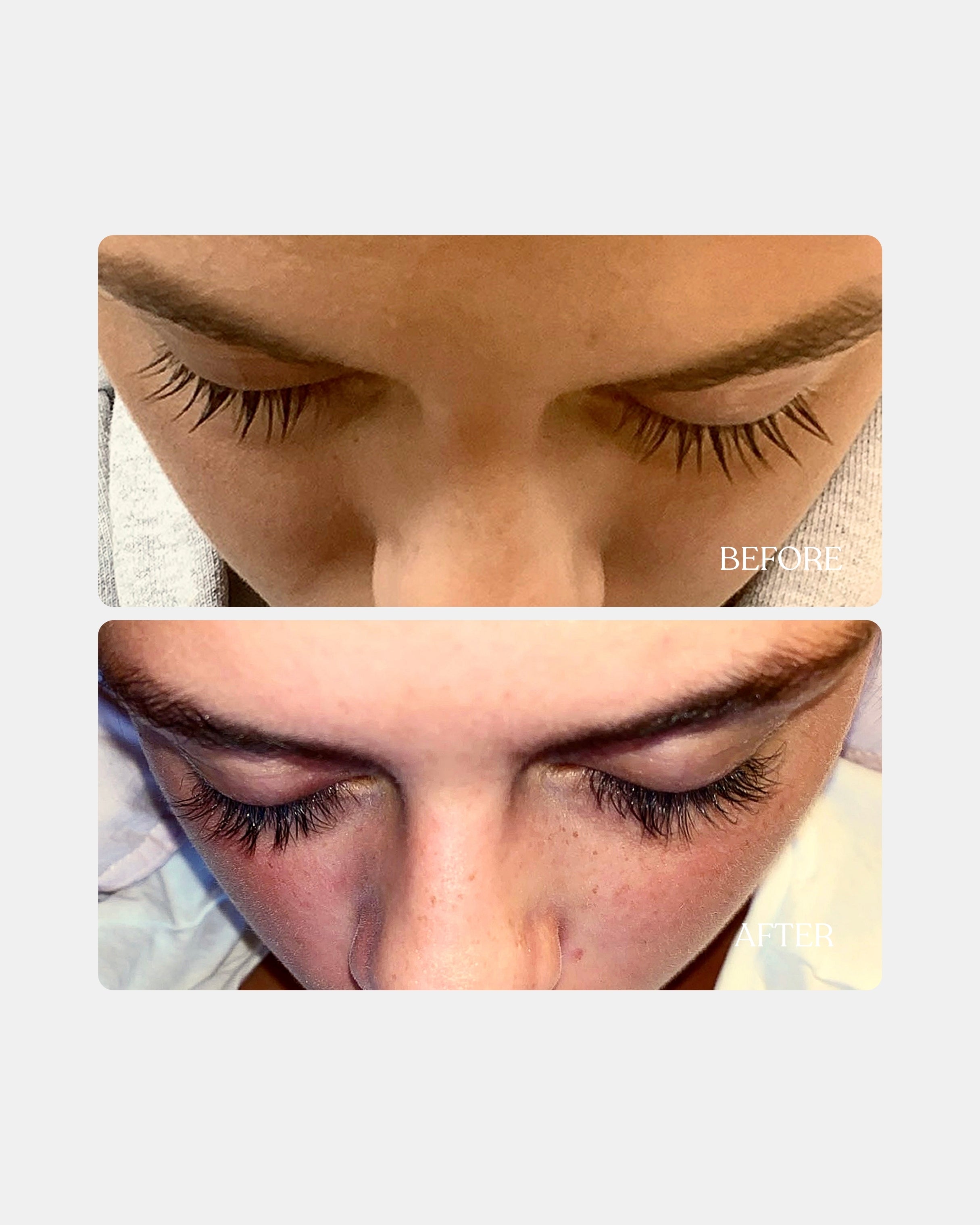 Eyelash serum