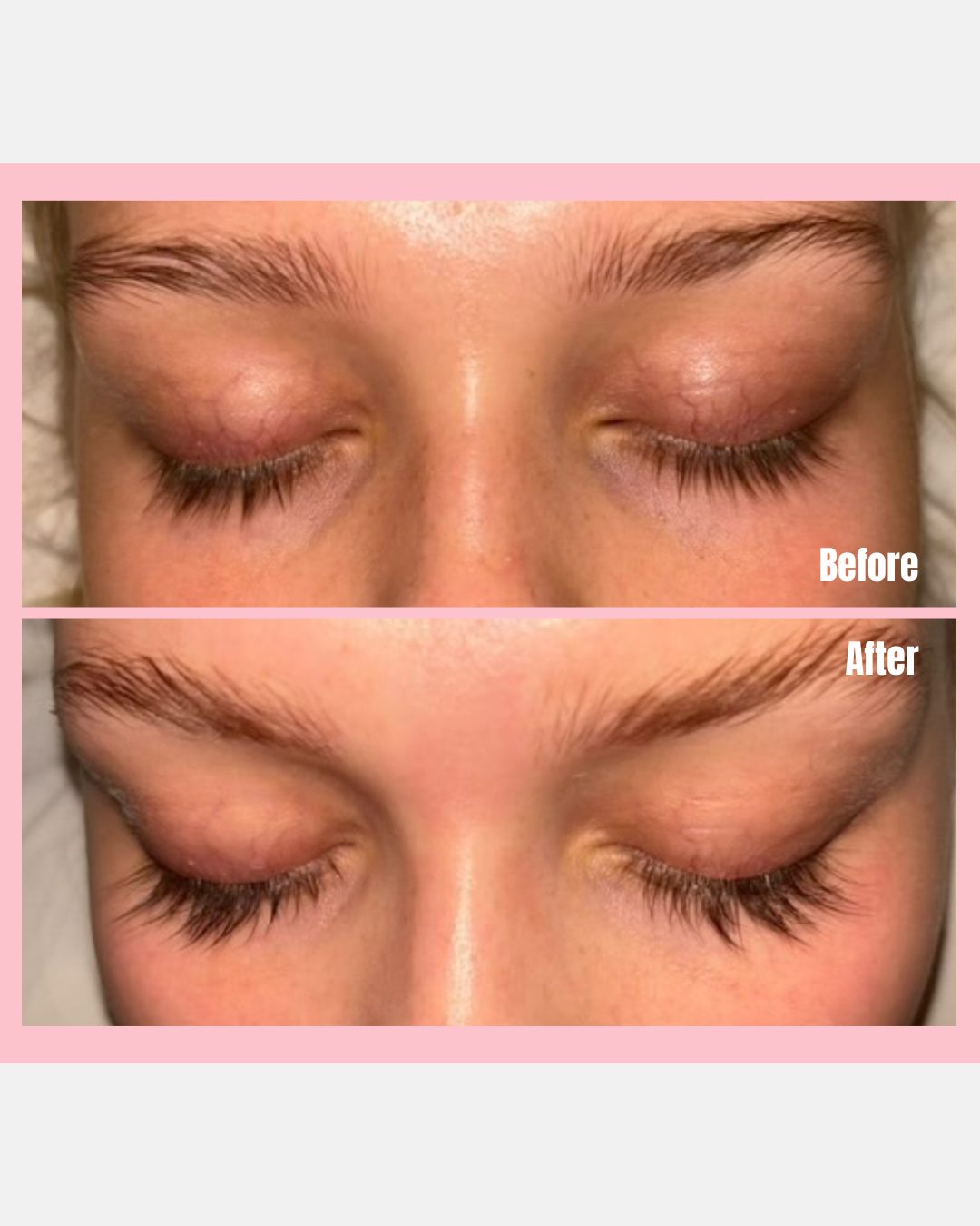 Eyelash Growth Serum