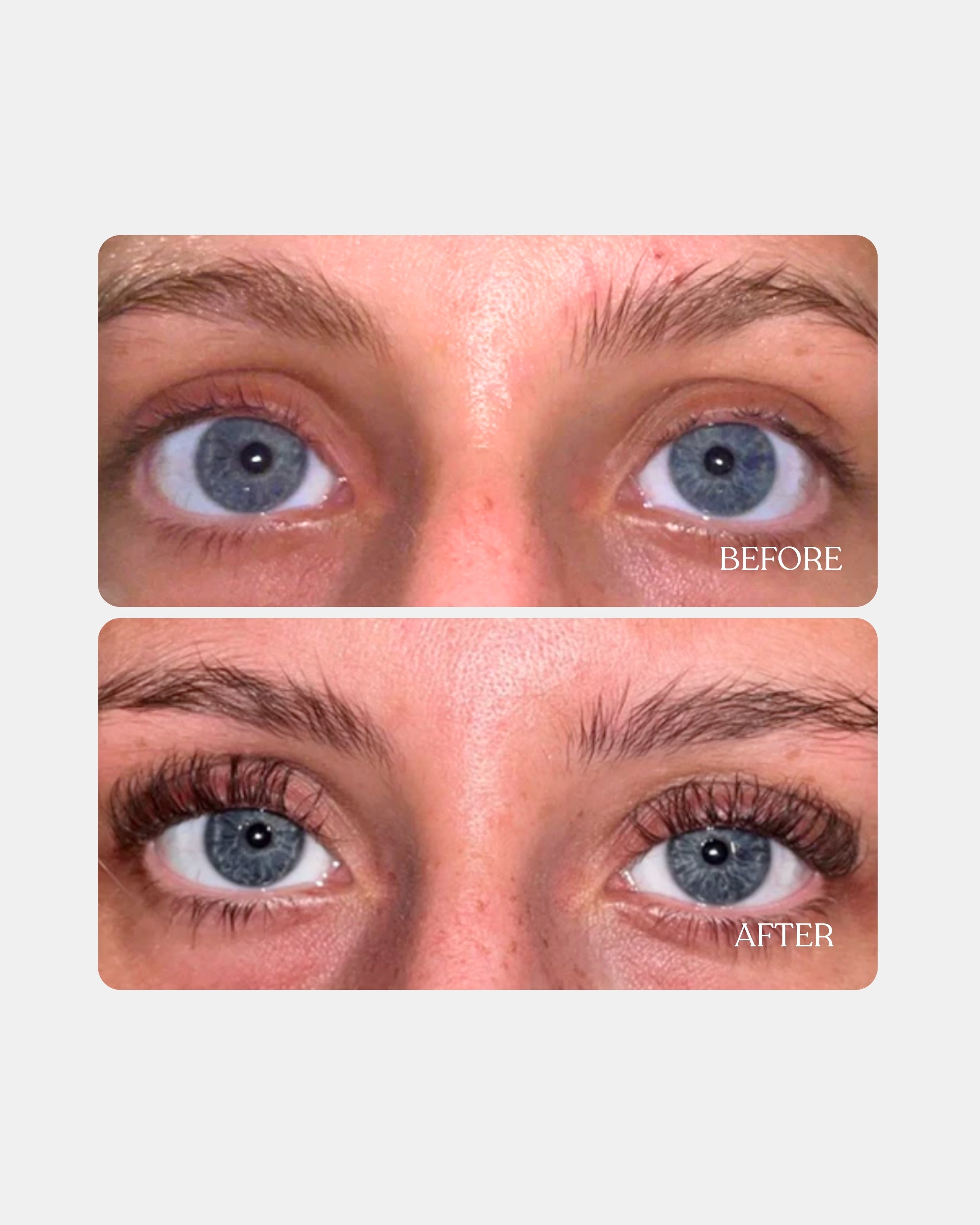 Eyelash serum