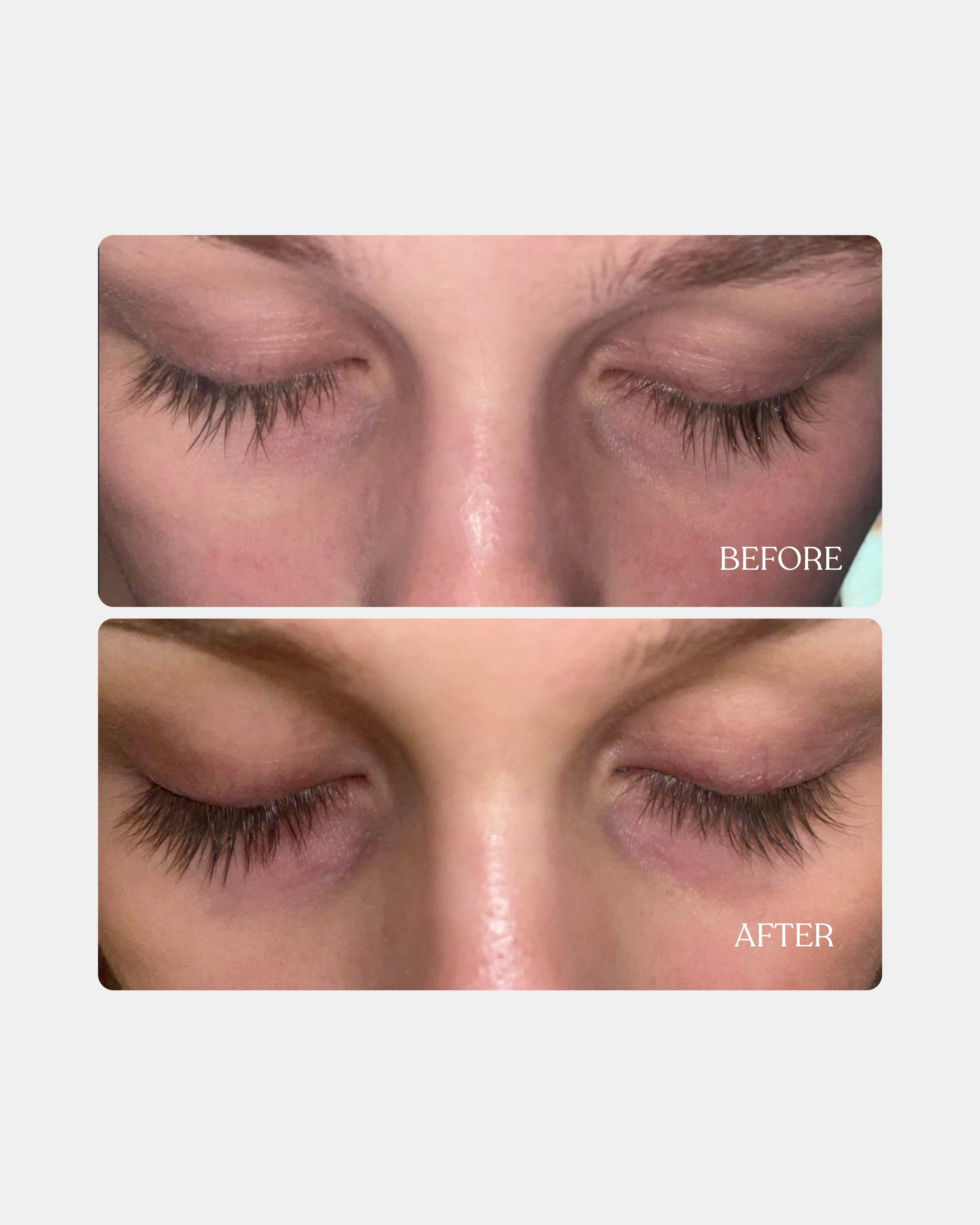 Eyelash serum