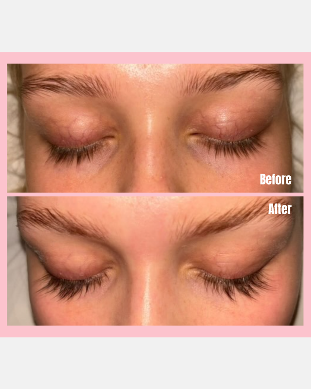 Eyelash Growth Serum