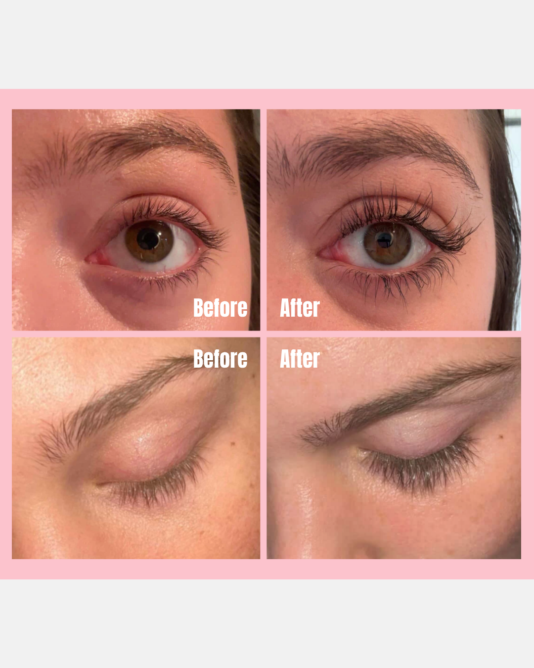 Eyelash Growth Serum